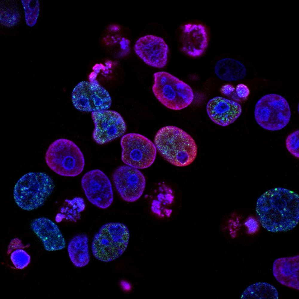 Stem Cell Therapy: Clinical Reality vs. Science Fiction